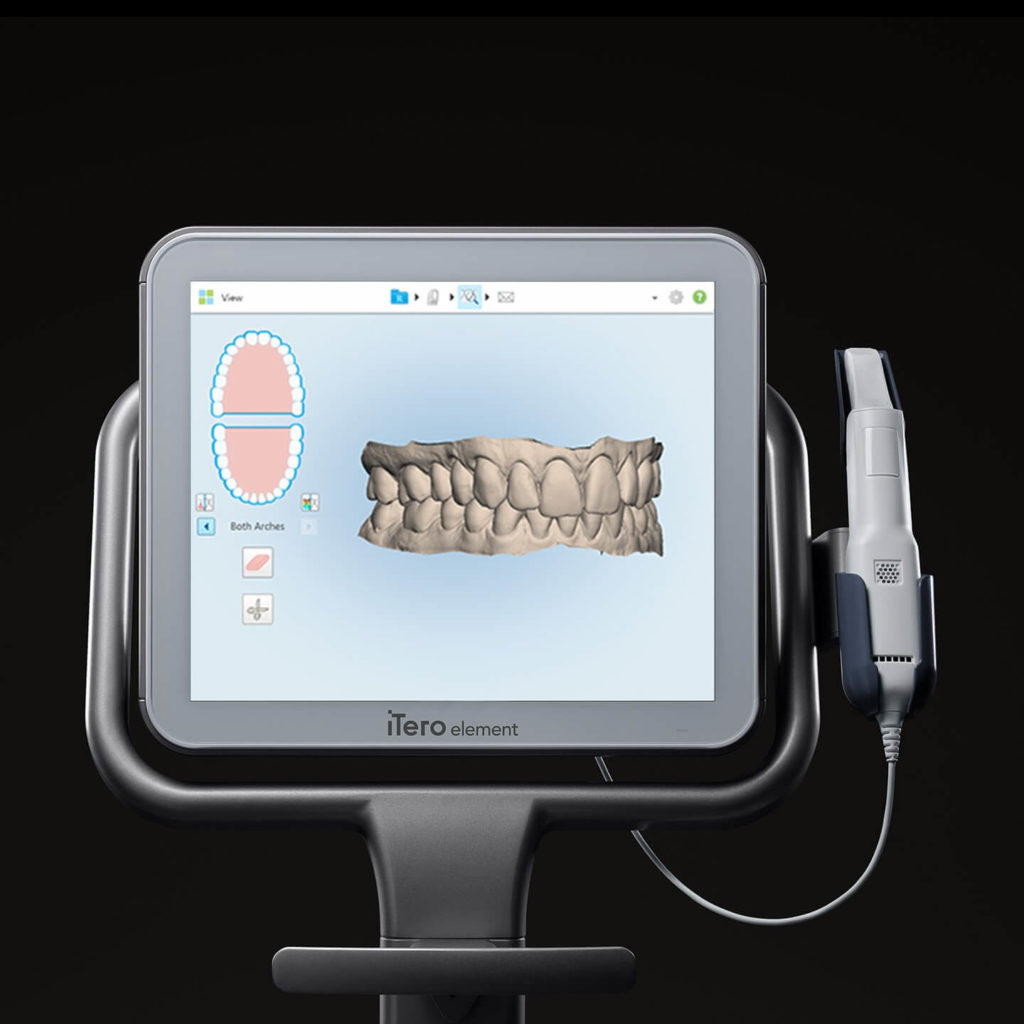 iTero Digital Scanning | Calgary Downtown Dentist | Welcome Smile Dental